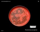 beta-hemolytic pseudomonas aeruginosa